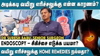 அடிக்கடி வயிறு எரிச்சலுக்கு என்ன காரணம்? | Endoscopy &ndash; சிகிச்சை எடுக்க பயமா? #endoscopy #fthealth