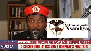 The Alien Skin Incident: A Closer Look at Nsambya Hospital's Practices.