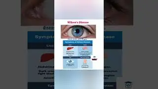 Wilson's Disease@FreeMedicalEducation-ld3sf#nursing#medical#viralshorts#youtubeviralshorts#Mbbs