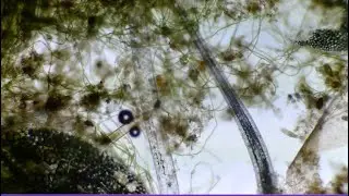 Microscope Lounge | One Hour of Living Micro-Worlds &bull; Slow Microscopy for Focus, and Relaxation