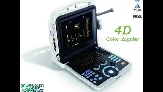 HD Demo video of 4D color doppler ultrasound scanner: testing the  carotid artery and liver