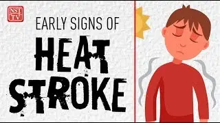 Early signs of heat stroke