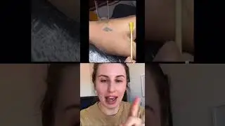 Zapping Tattoos&hellip;How Laser Tattoo Removal Works!