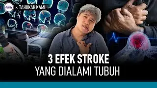 Ini 3 Hal yang Terjadi Pada Tubuh Saat Serangan Stroke | Hidup Sehat tvOne
