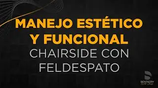 Manejo Est&eacute;tico y Funcional Chairside con Feldespato | Dentistry Web Class