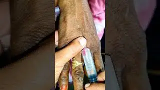 Intravenous Injection Procedure | IV Injection Step by Step | Nursing Skill Video #shorts #trending