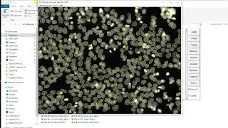 Analisis Automatico y Cuantitativo de Inmunofluorescencias - ImageJ y Macro - Parte1