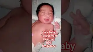 nicu baby recover from grunting rds smily face #neonatalcare #tinyfighter
