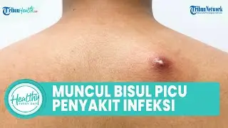 Waspadai Munculnya Bisul pada Tubuh Dapat Picu Infeksi, Begini Cara Atasi dengan Bahan Alami