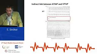 2nd Heart Rhythm Research Forum - Prof. Dr. Erwin Str&ouml;ker