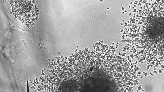 Angry Hemocyte ball Exploding