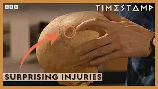 ‘Surprising’ Injuries Revealed On Skeleton of Medieval Priest | Meet the Ancestors | BBC Timestamp
