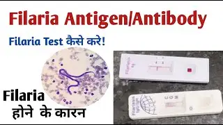 microfilaria antibody test I filaria antigen test