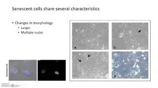 Cell Senescence