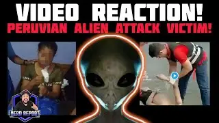 SHOCKING FOOTAGE! Peruvian Local Attacked by ALIEN? -  REAL OR FAKE?
