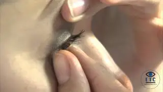Retirer ses lentilles souples