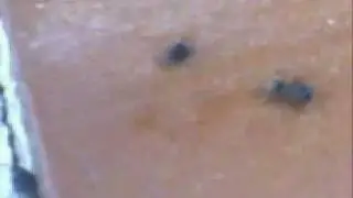 A FORMIGA LOUCA