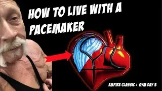 Can I Exercise with a Pacemaker in 2023? [ HD ]