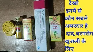 Top 5 cream & lotion for fungal infection | DEROBIN | ZALIM & SAPAT LOTION |RAJNISH LOTION| RINGOZON