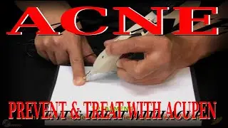 Acne | Prevent and Treat Acne with Electronic Acupuncture Pen | Acupen 1 | Acupressure VIKUDO