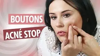 ACNÉ / BOUTONS : Ma routine soin anti imperfections - Cyrielle