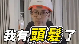 禿頭有救了？原本寸草不生的頭皮竟然長毛啦！生髮帽效果分享｜華森史塔森