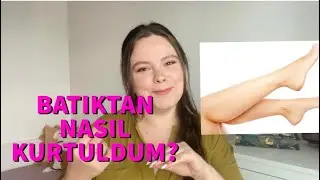 BATIKTAN NASIL KURTULDUM? Evde Acısız ve Ucuz👌🏻