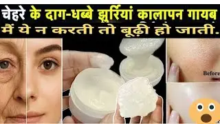 Alum & rice magic remove wrinkles dry dark skin shrink open pores how to use fitkari on face #vlog 