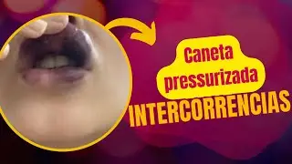 Evite intercorr&ecirc;ncias com a caneta pressurizada! &Aacute;reas de risco hyaluronpen.