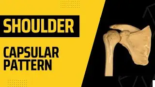 capsular pattern shoulder