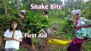 Snake Bite Quick Life Saving First Aid|Herbal Treatment At Home