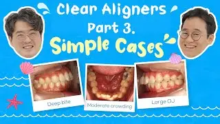 [Ortho Barista] Clear Aligners Part 3. Simple cases for dental practices (AI Voice-Over)