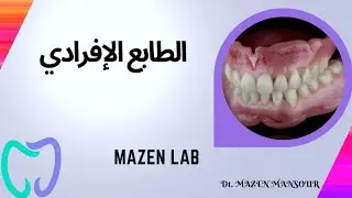 طريقة صنع الطابع الإفرادي