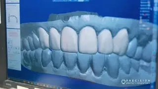 Modern Dental Pacific | Our Brands | Precision Dental Laboratory