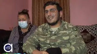 Hər iki gözündən xəsarət alan Qazimiz ad gününü qeyd etdi