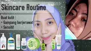 SKINCARE ROUTINE UNTUK KULIT MUDAH BERJERAWAT