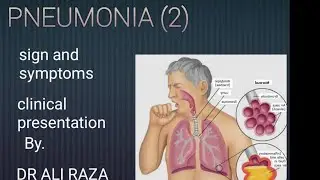 Pneumonia, sign and symptoms