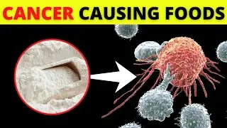 Cancer Causing Foods You Must Avoid | Foods That Cause Cancer | Cancer foods