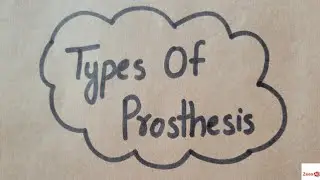 Types of Prosthesis||Body-Powered Prosthesis|| Externally Powered Prosthesis(Myoelectric Prosthesis)
