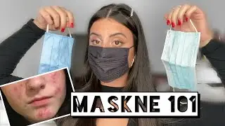 MASKNE: How to Prevent + Get Rid of Mask Acne | Tips & Tricks