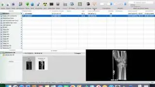3  How to add a report to a Osirix study