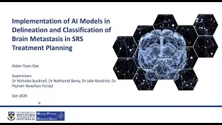Aidan Yuen-Oye : Deep Learning for Brain Metastasis Radiosurgery