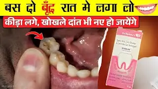 Stolin Gum Astringen /सिर्फ 1 बार लगाएं &ndash; दांत का कीड़ा, दर्द और मसूड़ों की सूजन जड़ से खत्म