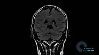 Do you dread MRIs because of the noise or the cramped space?
