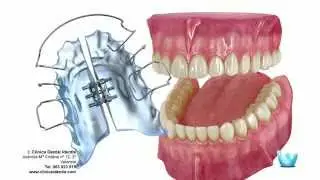 Ortodoncia: Estética o Prevención para la salud bucal?