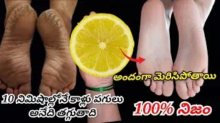 Cracked legs will be reduced in just 10 minutes and your legs will become beautifully shiny.