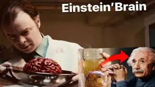 How Einstein&rsquo;s brain is different from normal persons