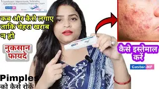 Castor NF skin cream| How to use castor nf skin cream| Pimple ko kaise roke