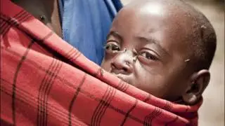 What is the significance of neglected tropical diseases?