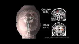 Le r&ocirc;le de la douleur persistante dans l&rsquo;axe intestin-cerveau QPRN | RQRD